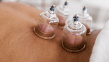 Image for 45 minute cupping treatment