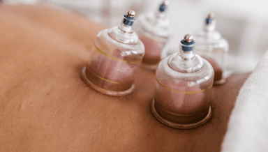 Image for 30 minute cupping treatment
